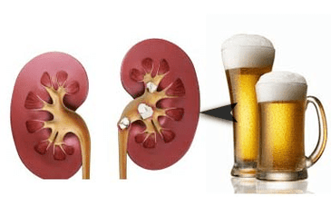 L'effet de l'alcool sur les reins